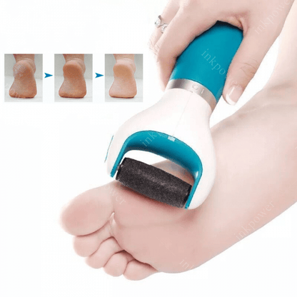 Pediflexy™️Foot Roller Callus Remover